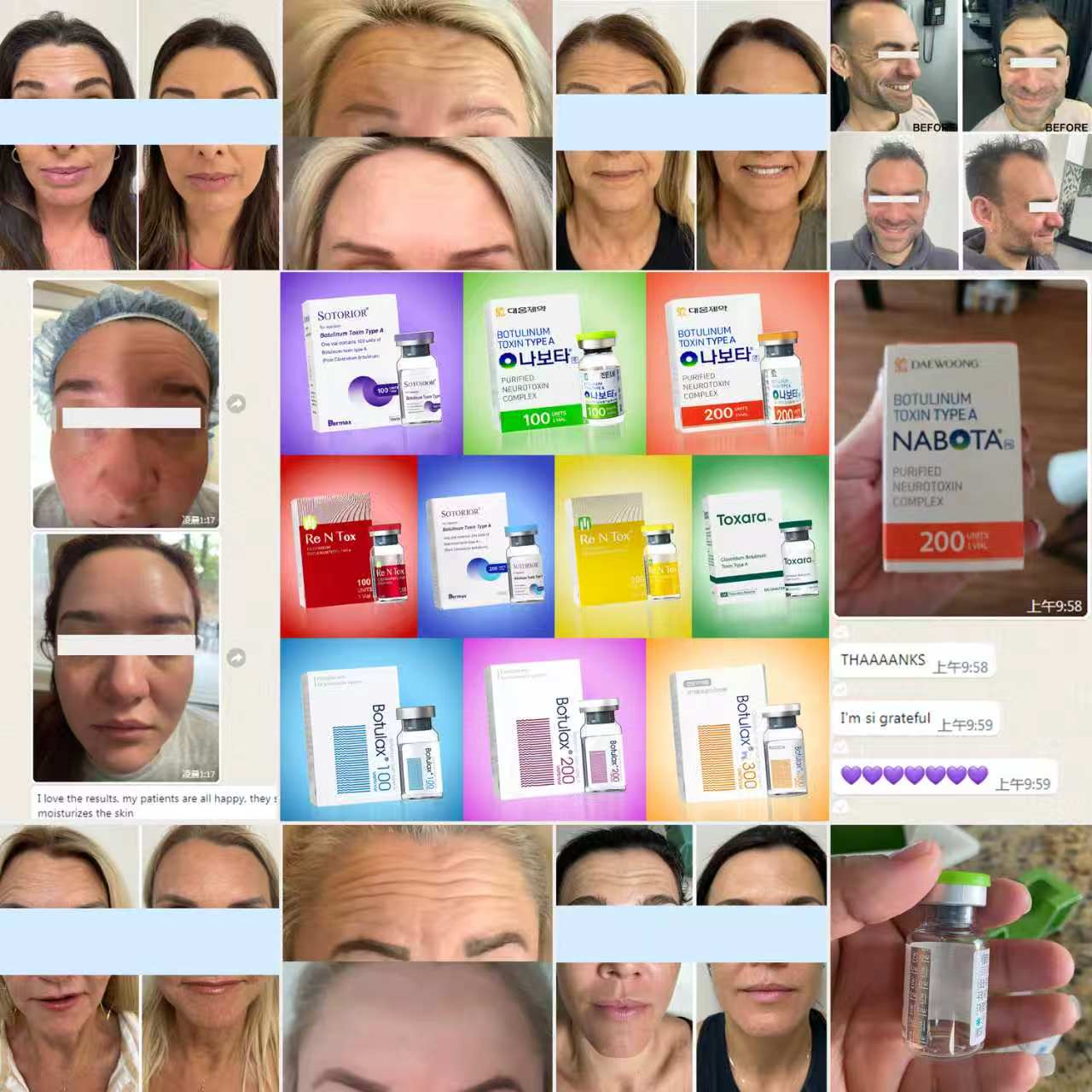 botulinum toxin type a for sale botulinum toxin type a for sale