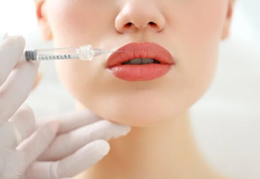 Needleless Lip Filler