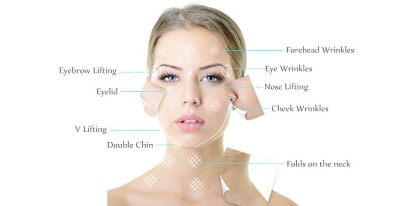 21g Gauge Cog Pdo Thread-Product Usage 1 21g Gauge Cog Pdo Thread-Product Usage 1