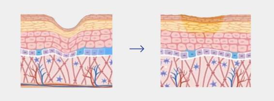 Buy EXOBLOOM™ Exosome (3) Buy EXOBLOOM™ Exosome (3)