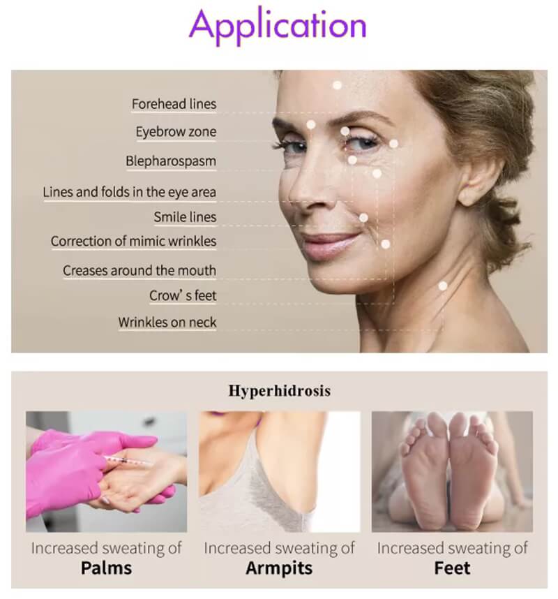treatment areas treatment areas
