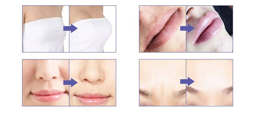 Product Details Product Use Comparison Product Details Product Use Comparison