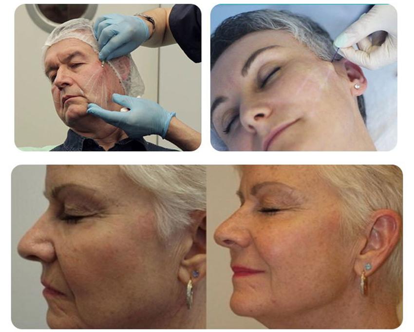 Before & After 1 Before & After 1