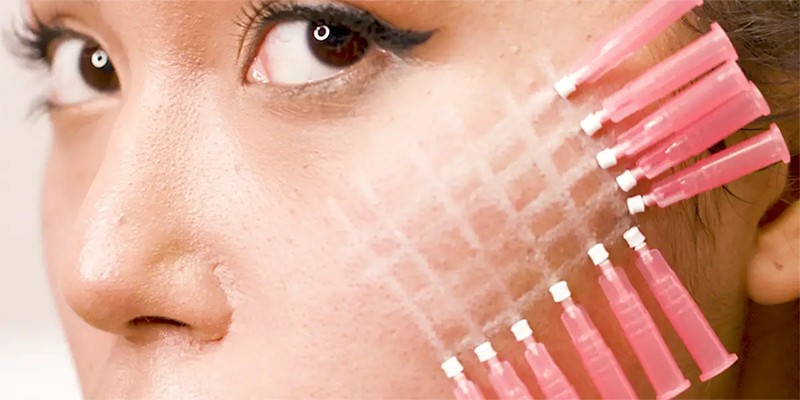 There Is a Great Demand for Non-surgical Aesthetics, Magik PDO Thread Lifts Are a New Way to Achieve Instant Skin Tightening (2) There Is a Great Demand for Non-surgical Aesthetics, Magik PDO Thread Lifts Are a New Way to Achieve Instant Skin Tightening (2)