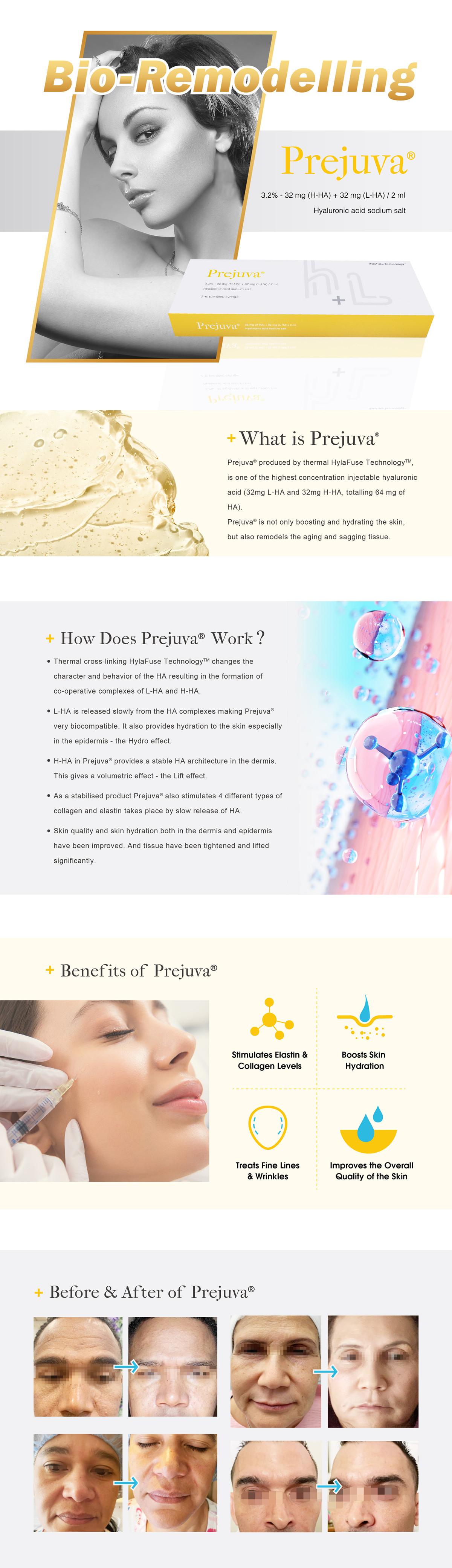 Prejuva Injectable Skin Remodelling Prejuva Injectable Skin Remodelling