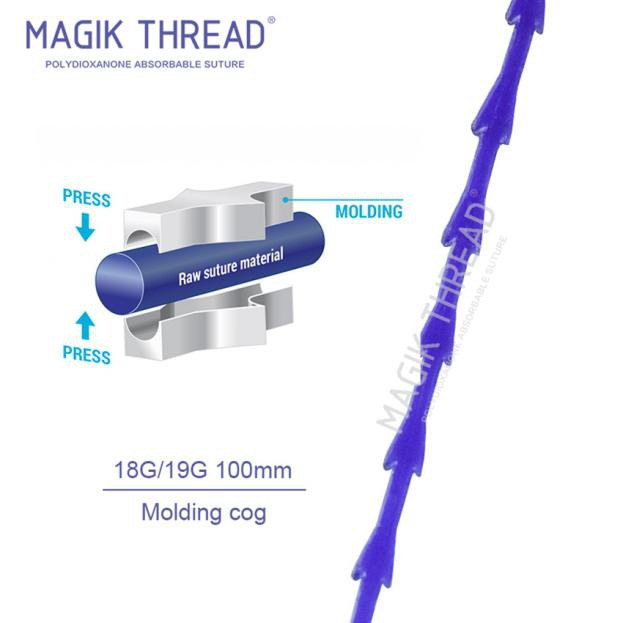 What are the advantages of a thread lift (4)