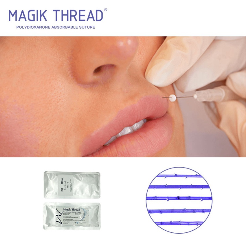 What should know before get threads (5)