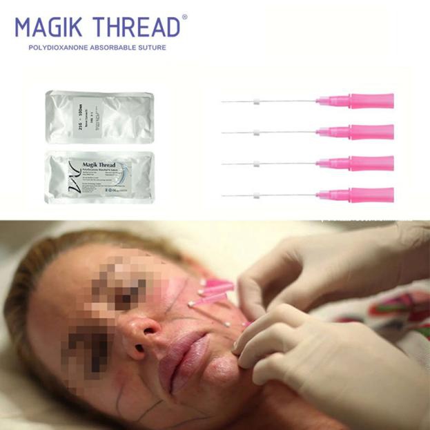 Am I suitable for PDO threads (2)