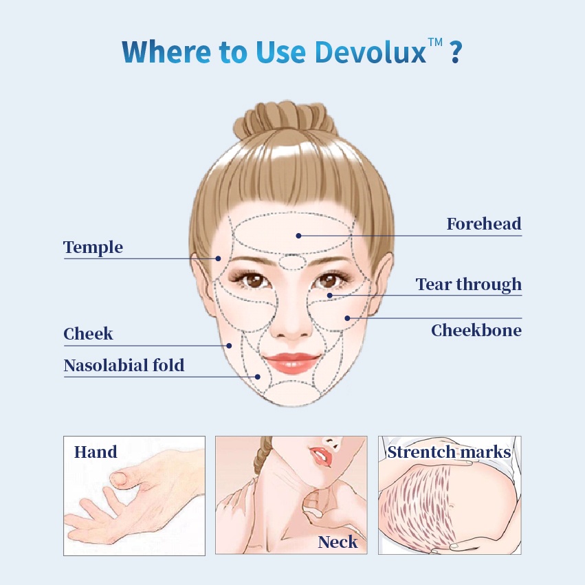Do you know about devolux PLLA?
