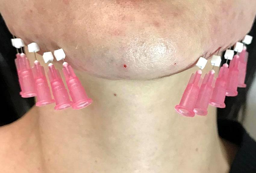 Mono PDO Thread How It Works