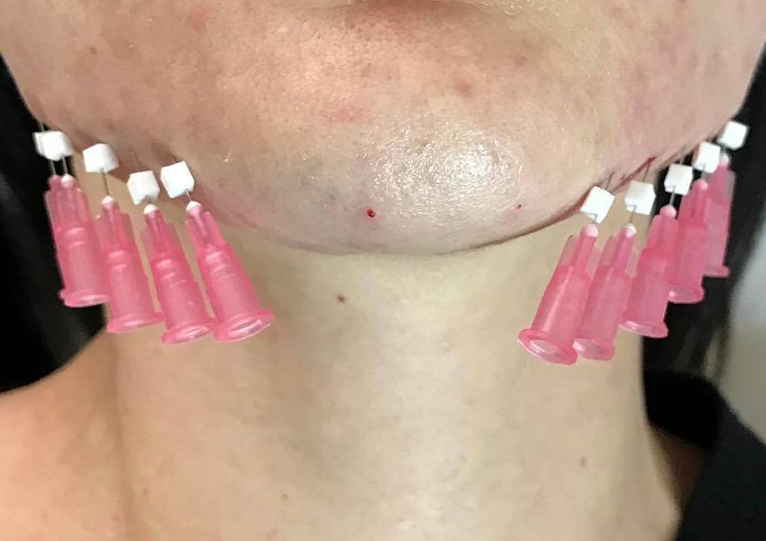 Mono PDO Thread How It Works (2)