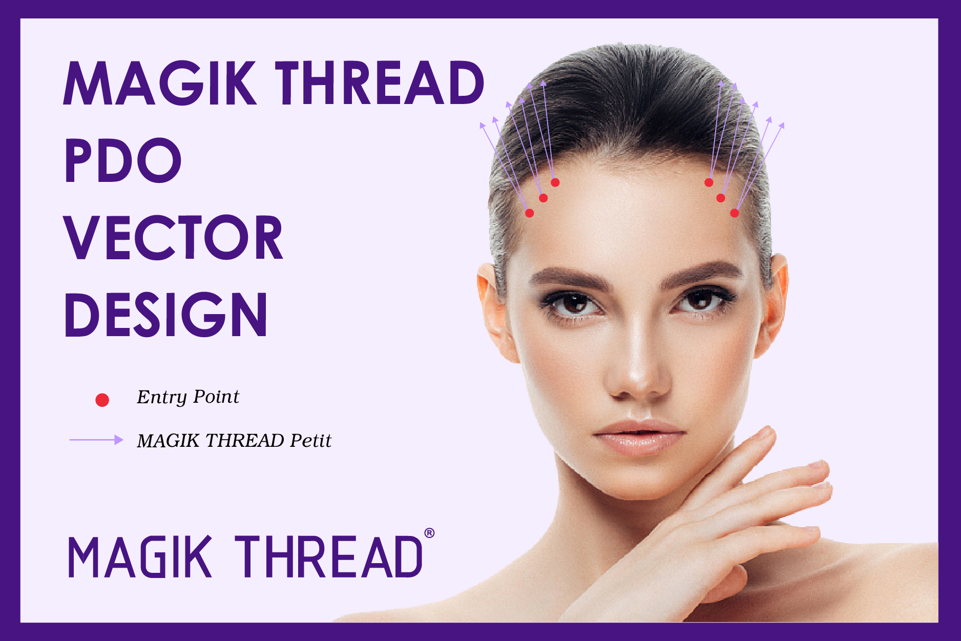 Which is better PCL\ PLLA or PDO thread?