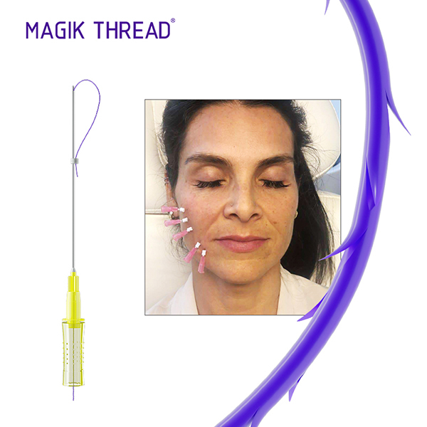 Cog 3D PDO Thread Usage for Wrinkle Removal