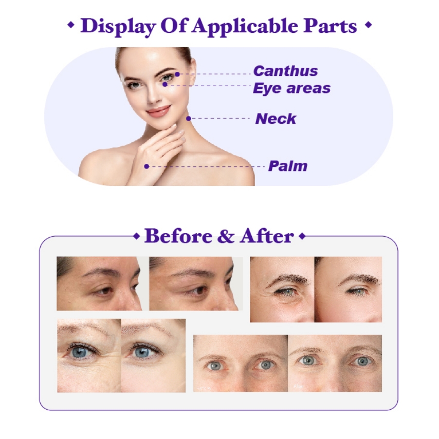 what are pdo mono threads