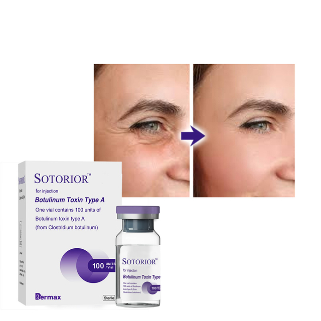 Toroxen Injection China Sotorior Toxin Injections manufacturers, Sotorior Toxin ...