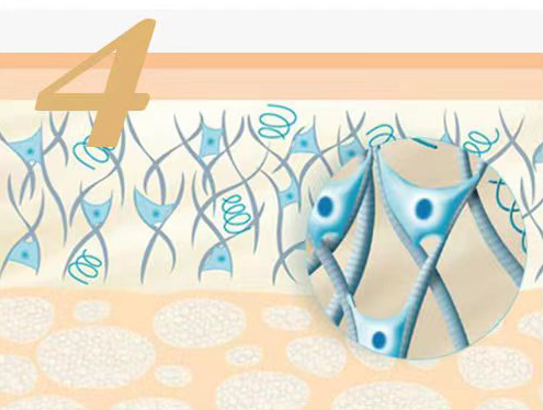 CHArmacy Calcium Hydroxylapatite Fillers Injections work