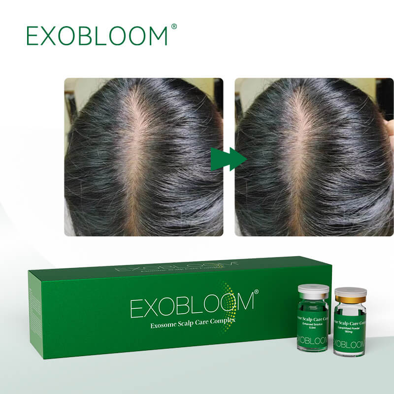 EXOBLOOM Scalp Care: A High-Performance Exosomes Hair Serum