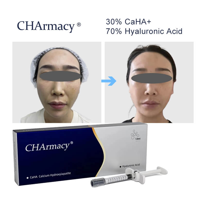 Does Hyaluronidase Work with CaHA Fillers? Expert Insights