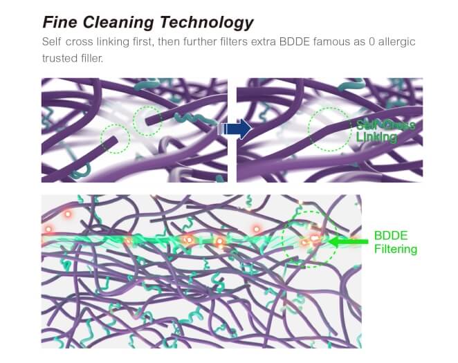 Technology of Macrolite Hyaluronic Acid Buttock Injections Filler (6)