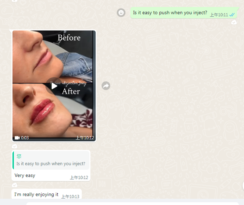 2ml lip filler before and after thin lips