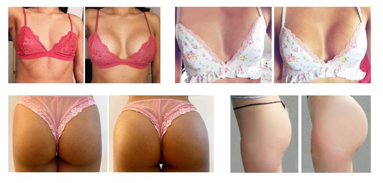 Macrolite Pro body filler before and after
