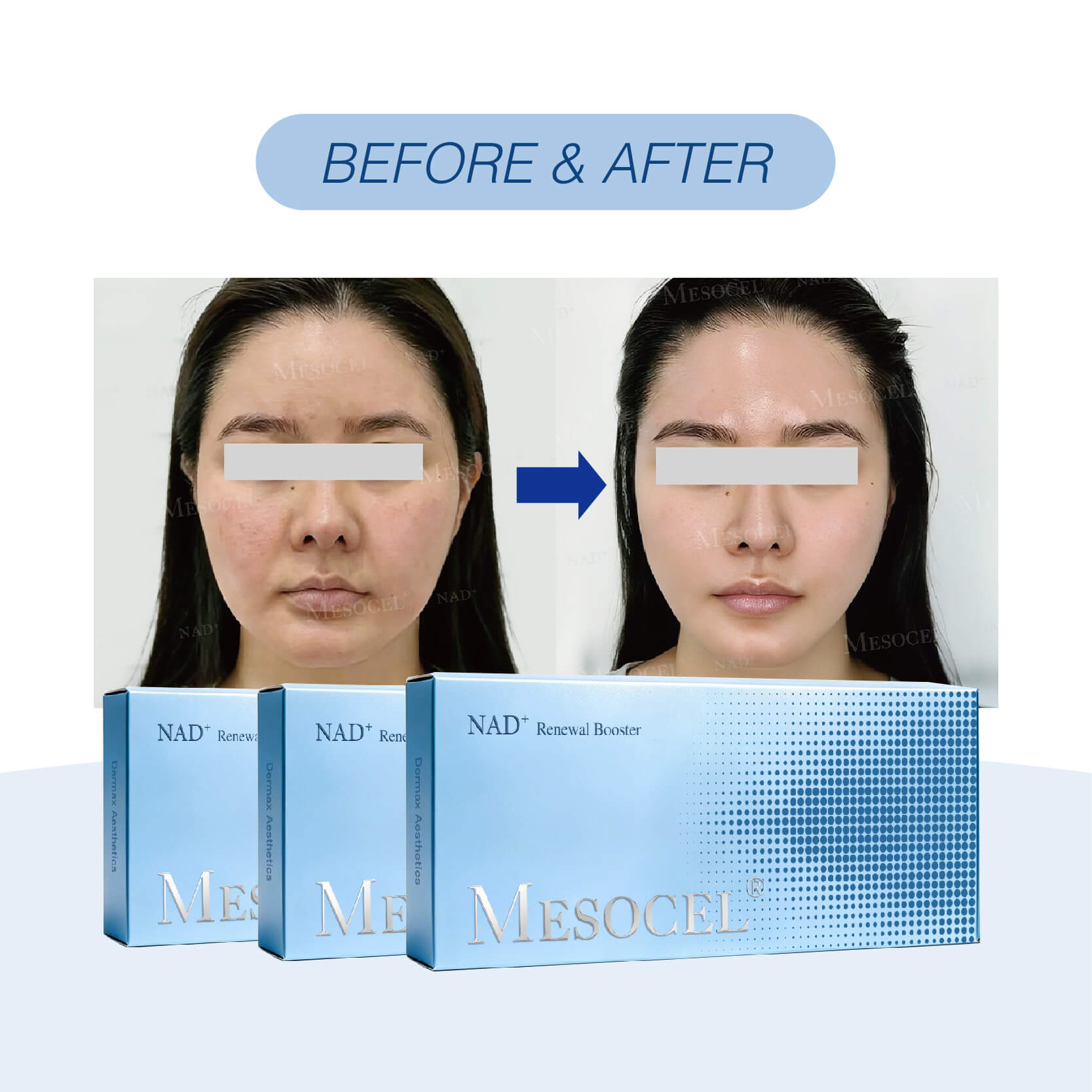 Does NAD Skincare Work? Benefits, Results and Treatment