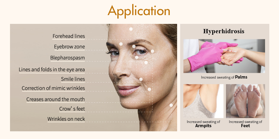 Application of Ren Tox Botulinum Toxin
