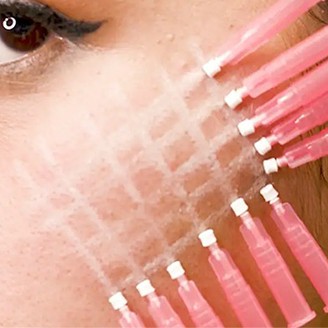 There Is a Great Demand for Non-surgical Aesthetics, Magik PDO Thread Lifts Are a New Way to Achieve Instant Skin Tightening