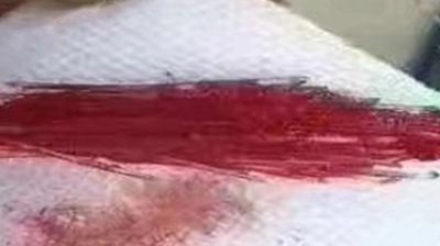 Other Company Thread Suture Material