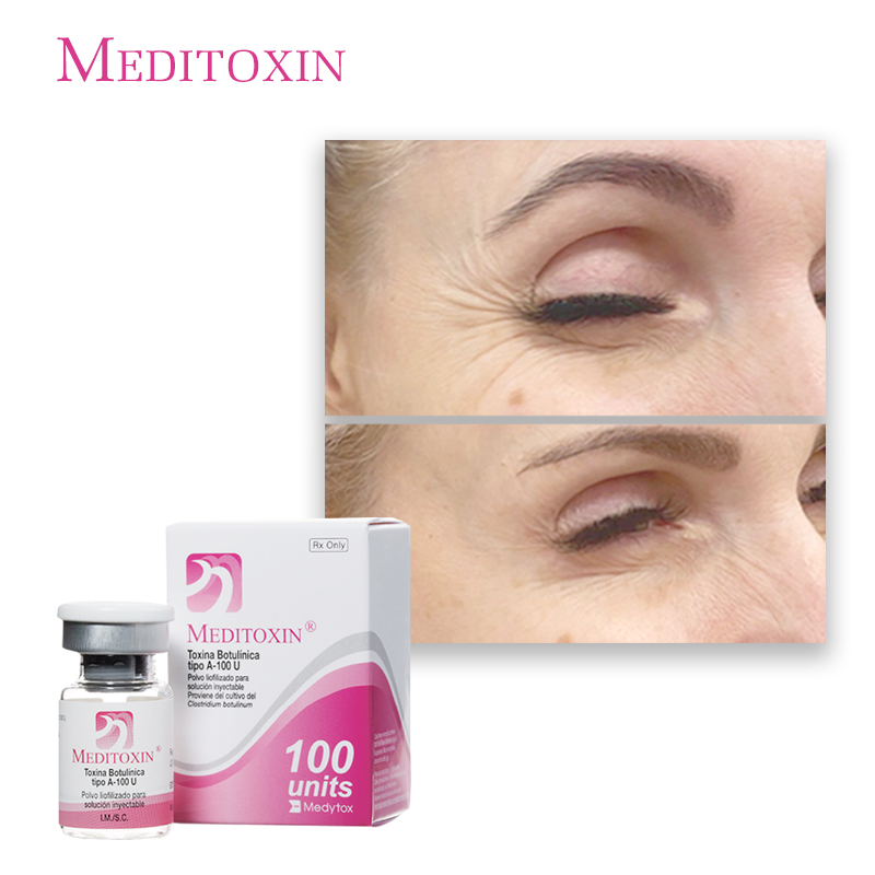 Who Can Buy Botulinum Toxin Type A 
