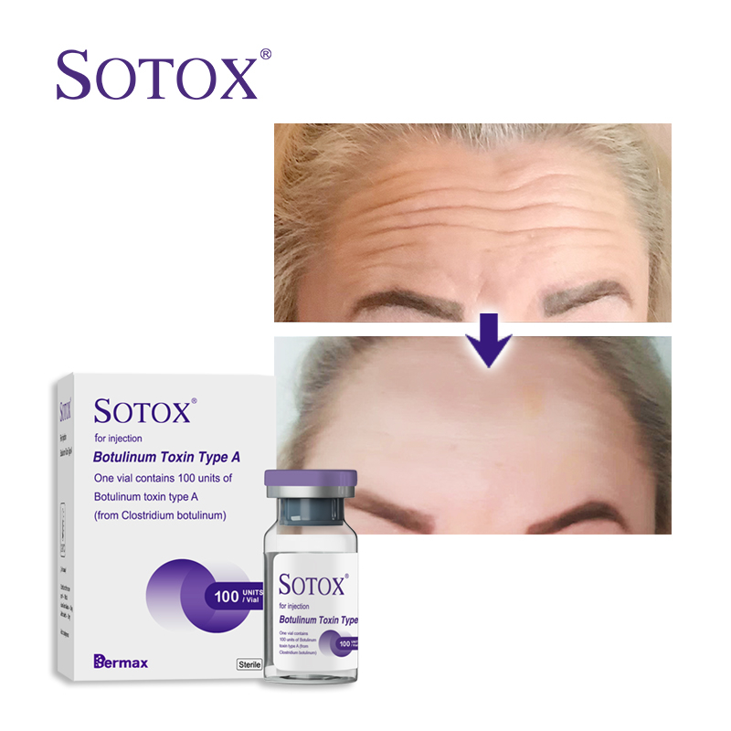 Botox 100 Units for Sale