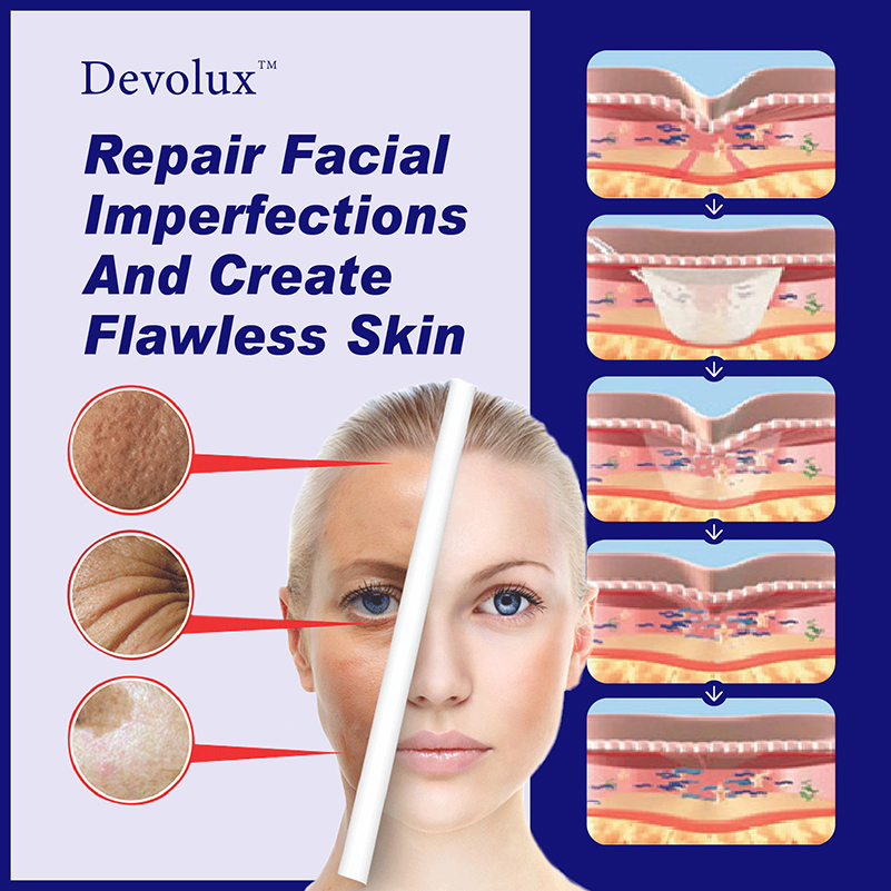 poly l lactic acid uses