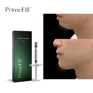 PrimeFill Polymethyl Methacrylate Microspheres Filler