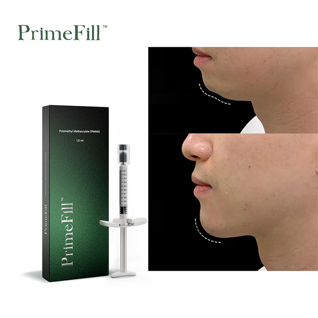 PrimeFill Polymethyl Methacrylate Microspheres Filler