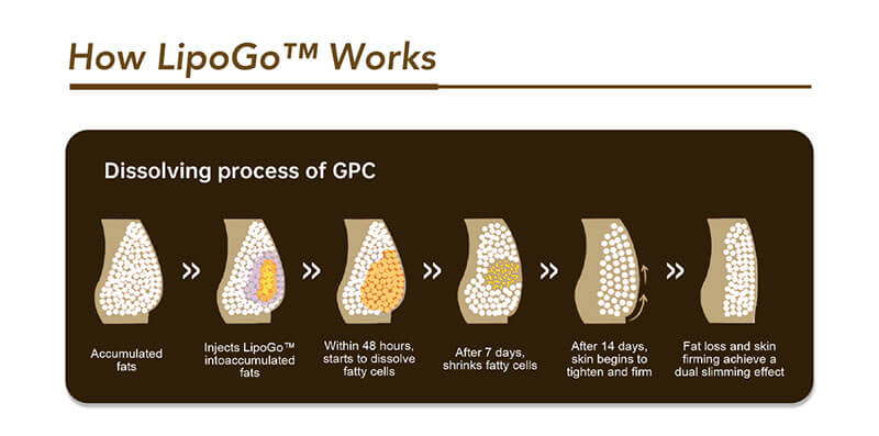 how lipogo lipotytic solution works