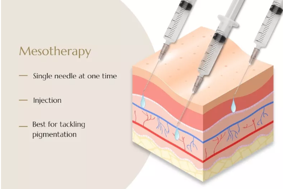 Mesotherapy