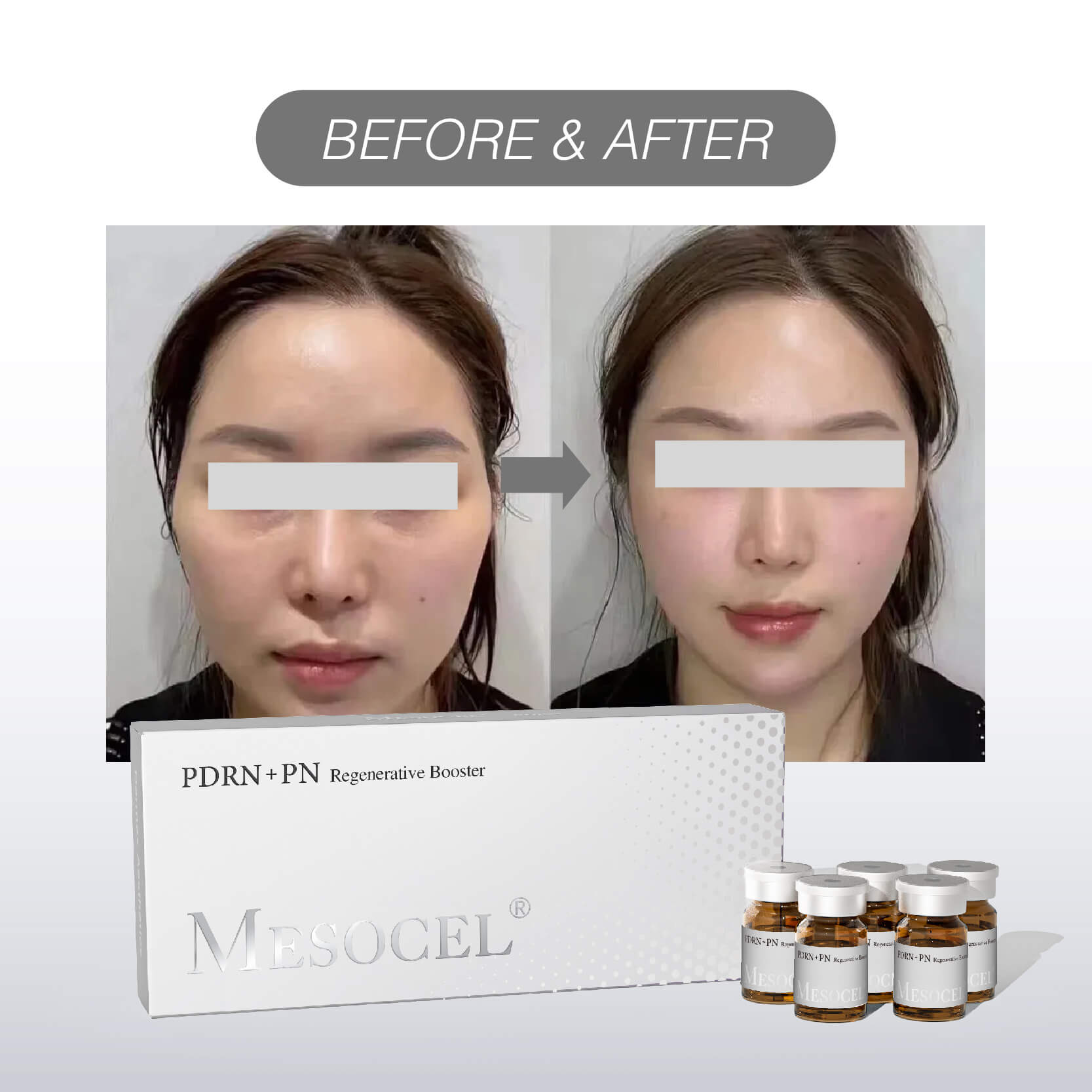 Mesocel&reg; PDRN+PN Regenerative Booster