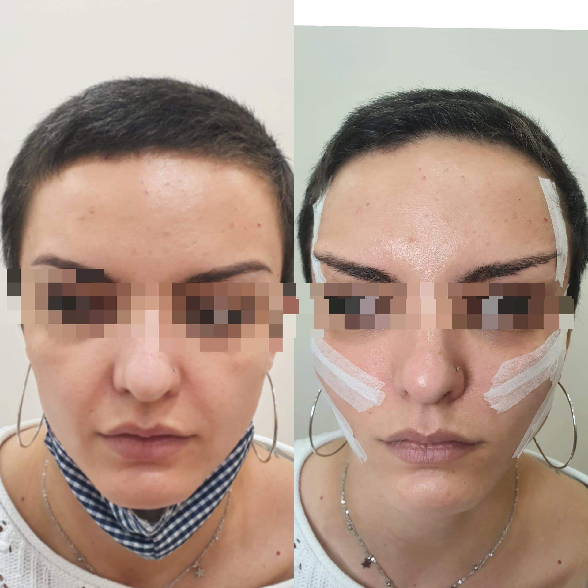 pdo mono threads before and after