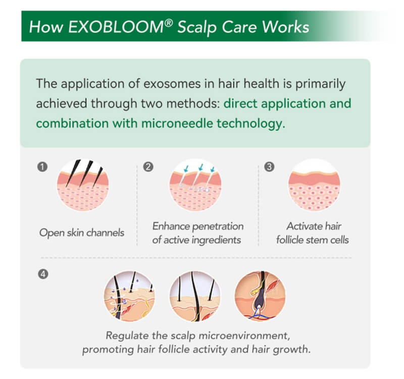 How EXOBLOOM&reg; Scalp Care Works