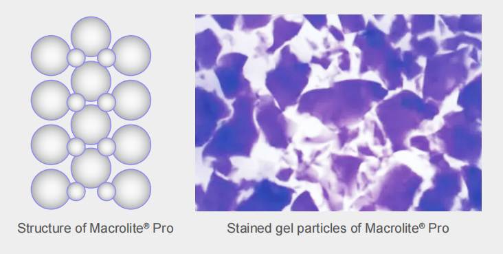 Macrolite pro body filler technology