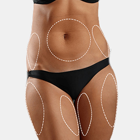 fat reduction comparison guide.jpg