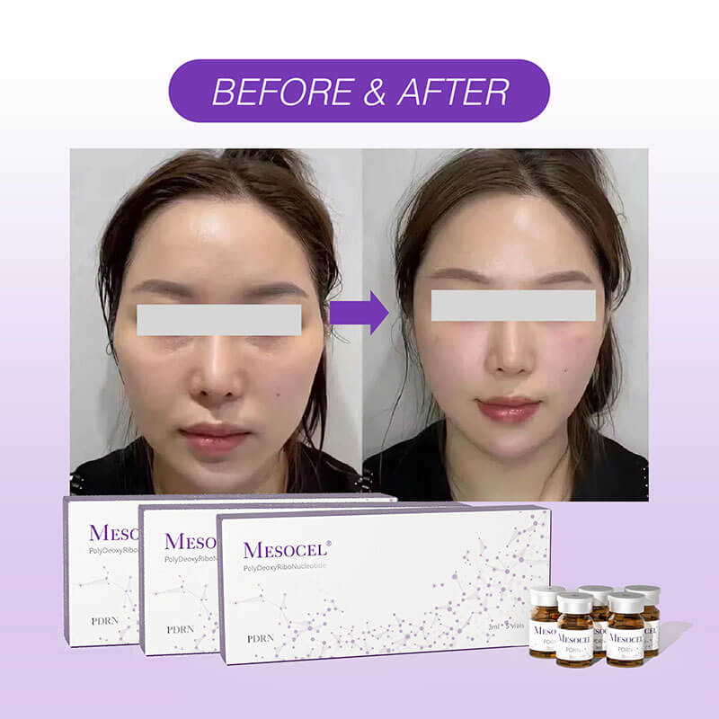 Mesocel PDRN Skin Booster