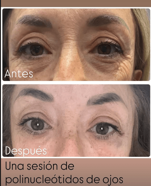 Before and After: Real Visual Progression