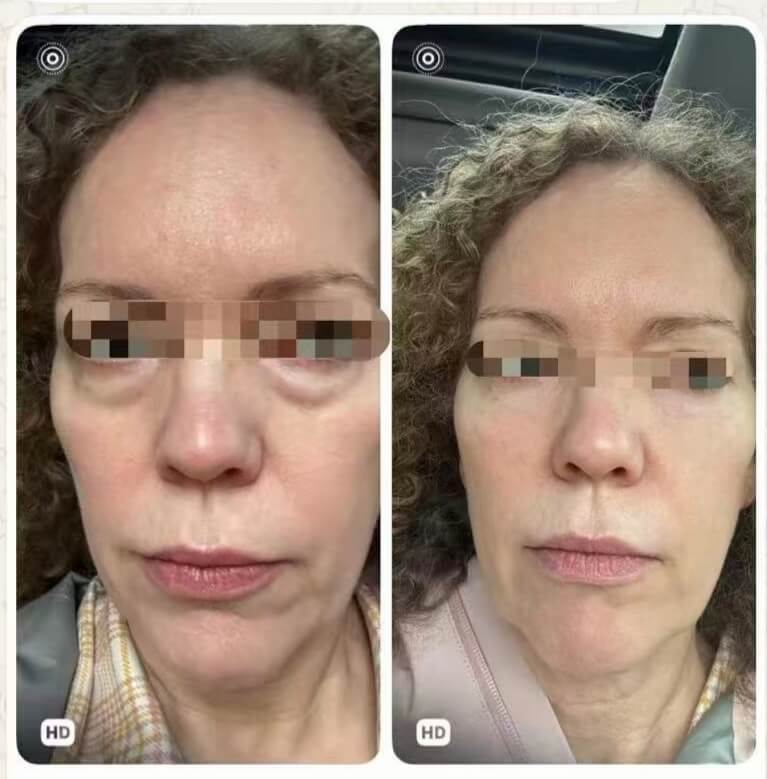 Before and After: Real Visual Progression