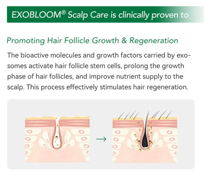 EXOBLOOM Scalp Care hair mesotherapy products are Clinically Proven To