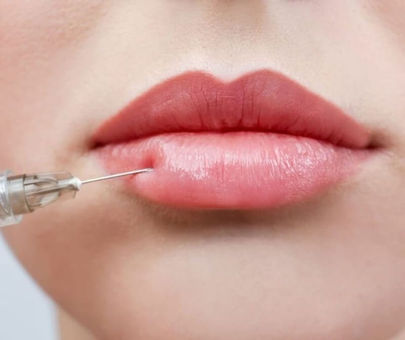 can you have skin booster after filler