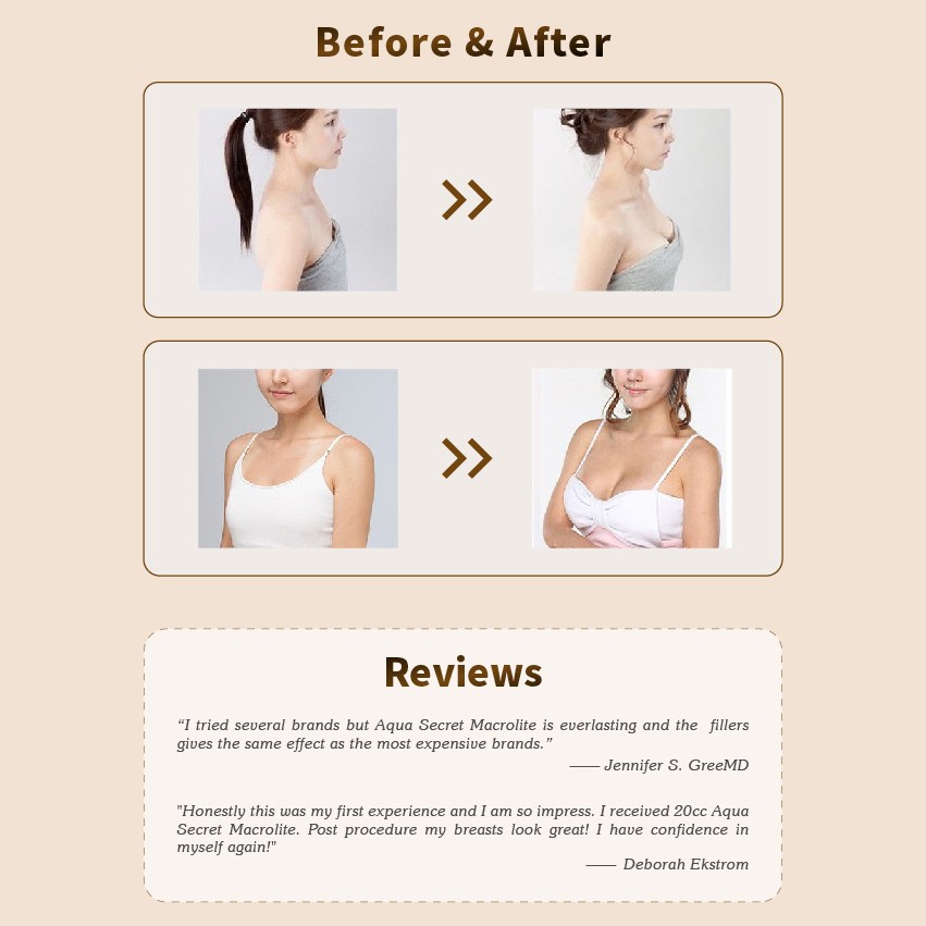 Mesocel Hyaluronic acid injection (6)