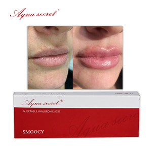 1ml Filler Lips Buy Online