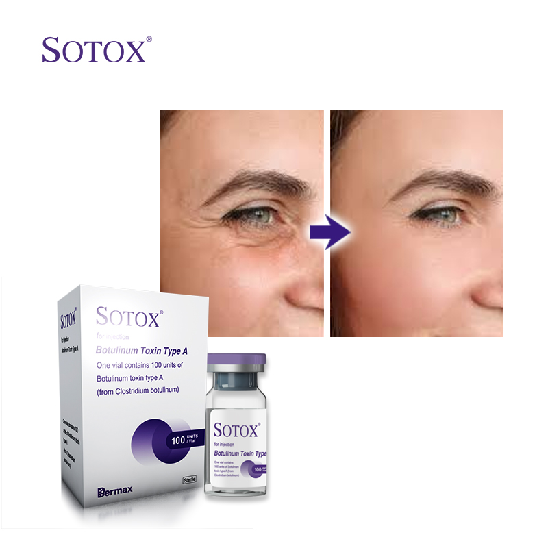 The price of Botulinum Toxin injection