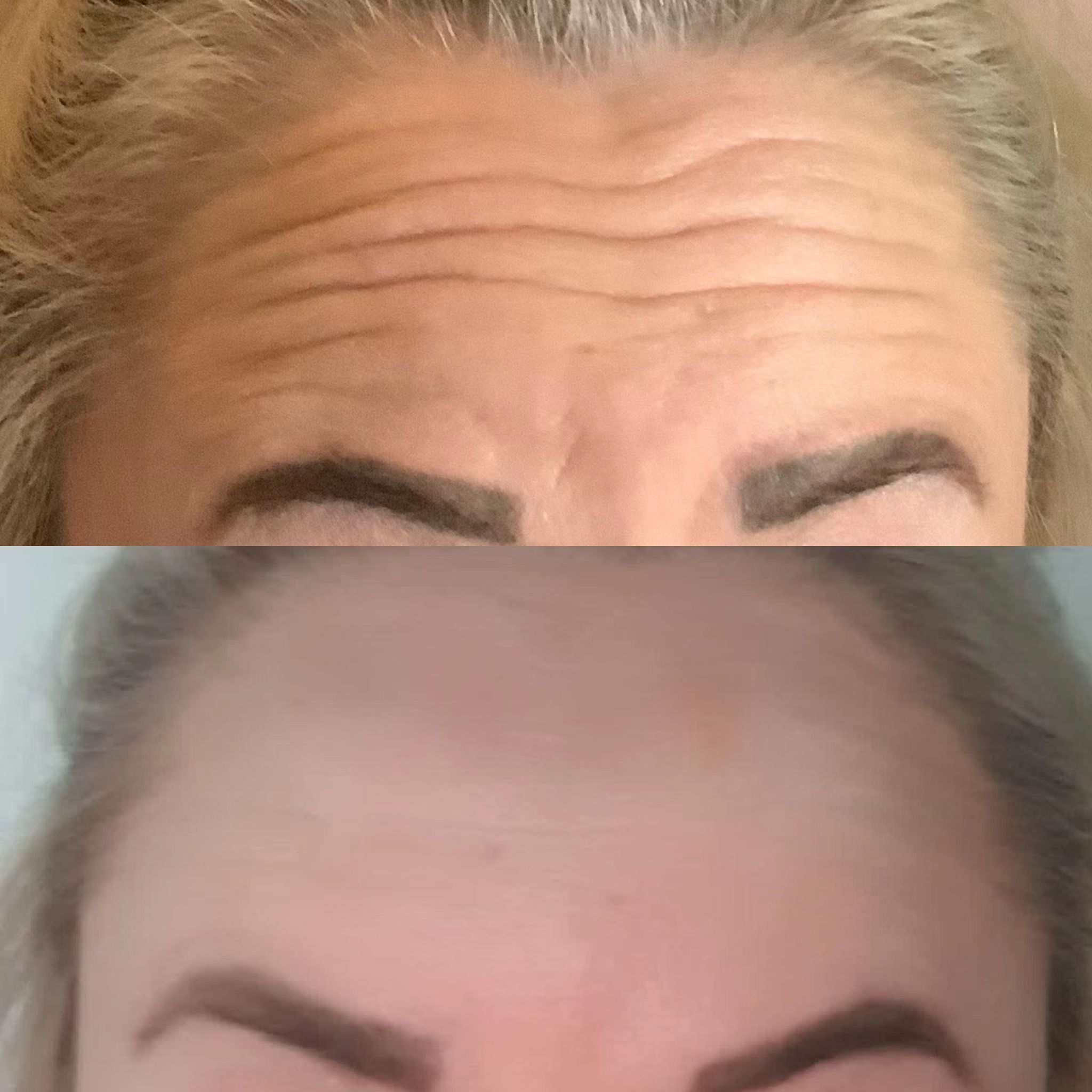 Sotorior Reviews Before And After